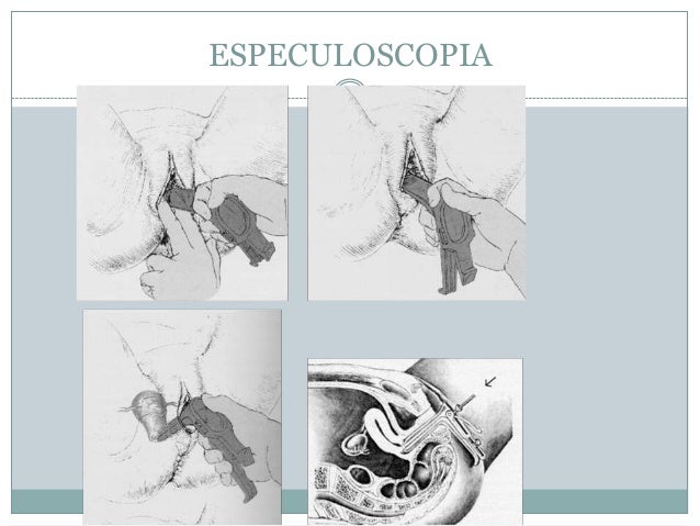 especuloscopia tecnica